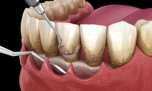 Dental Clinic in Perungudi,Dental Clinic in Taramani